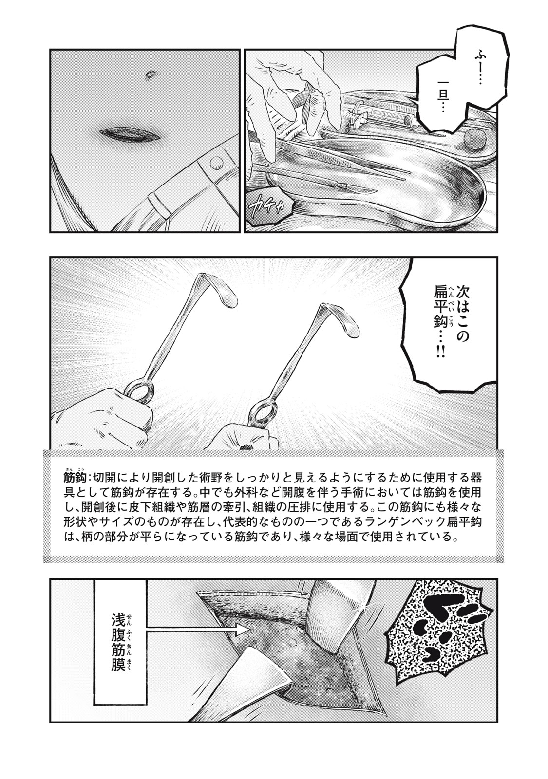 高度に発達した医学は魔法と区別がつかない 第17.2話 - Page 4